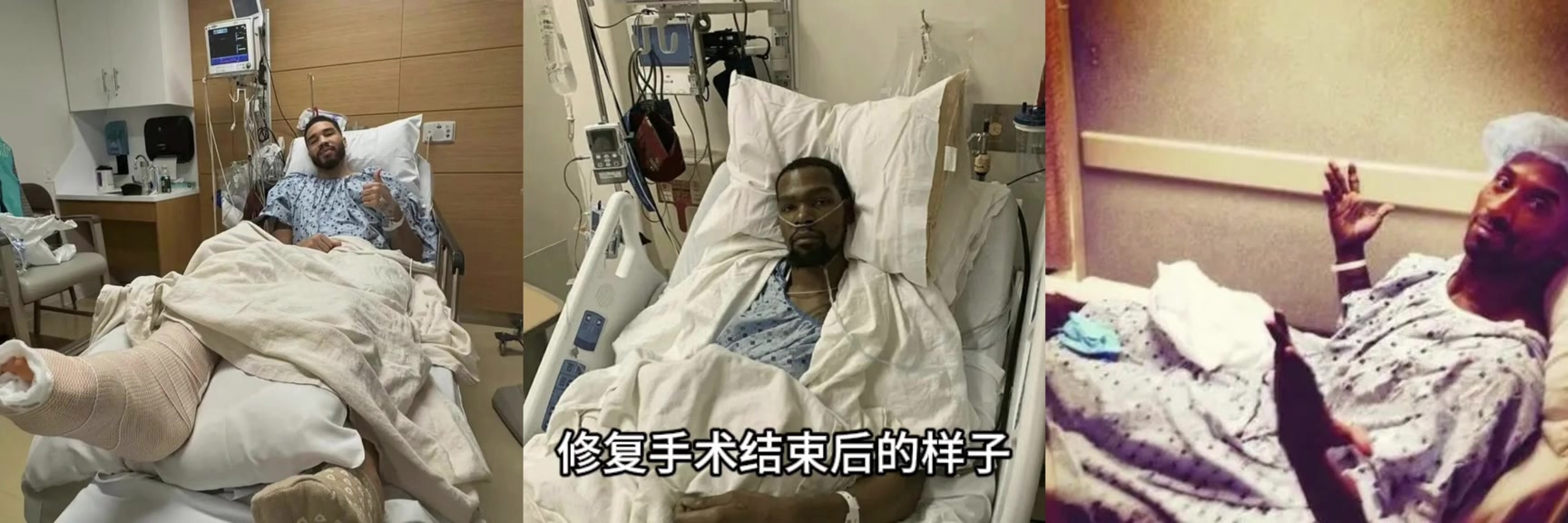KD最奇科比杜蘭特塔圖姆跟腱斷裂修復手術結束后的樣子
